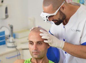 Explicacion tratamiento de micropigmentacion capilar paso a paso. Técnico especialista Oliver de New Hair Solutions