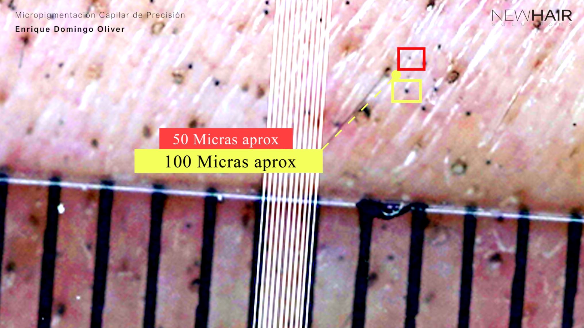 micropigmentacion capilar al microscopio
