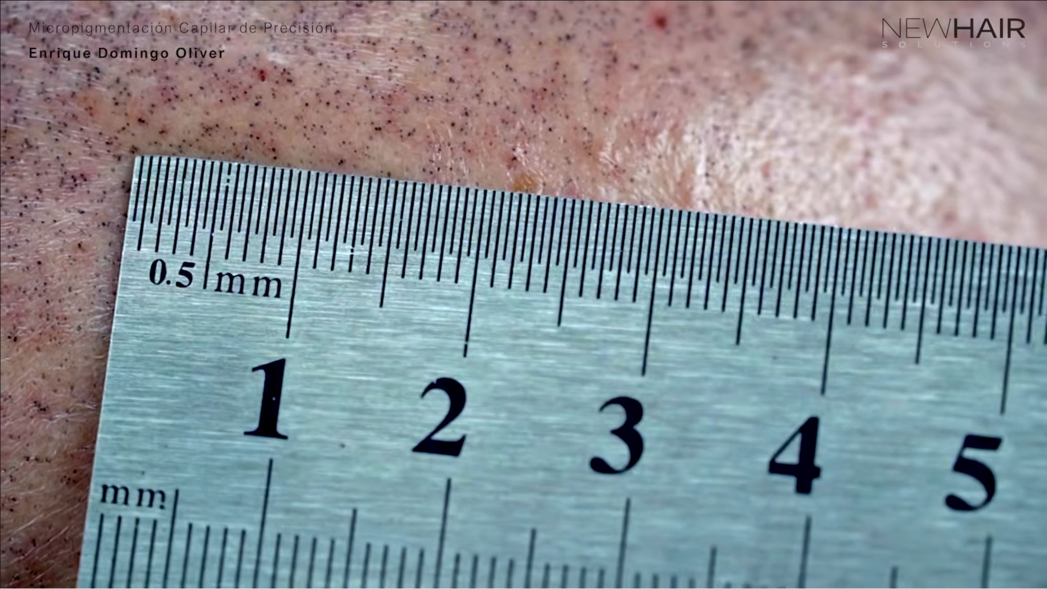 micropigmentacion capilar tamaño del punto